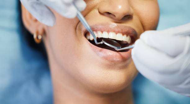 Best Emergency Dentist for Knocked-Out Tooth in USA